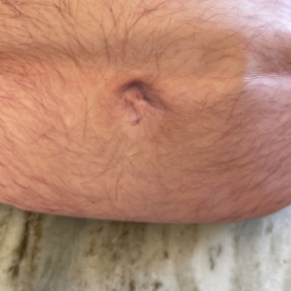 Fanny pack-hairy belly - Picture 6 of 6